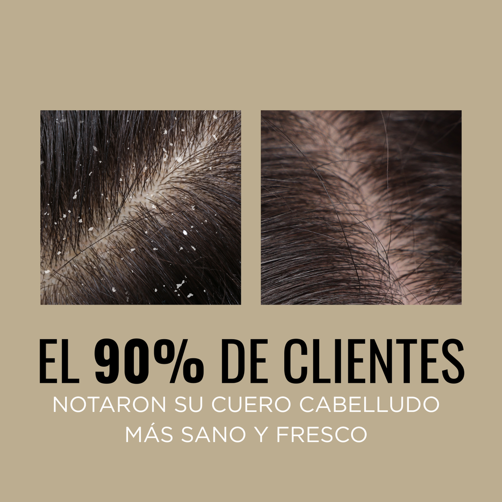 Shampoo Balance Anticaspa Refrescante