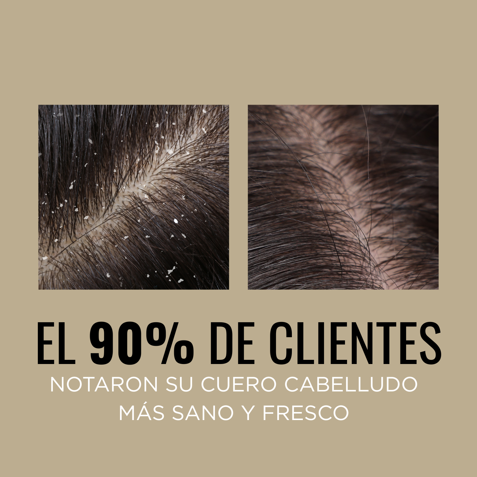 Shampoo Balance Anticaspa Refrescante